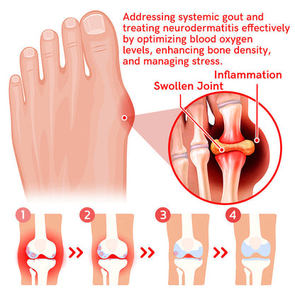 GFOUK™ IONFIR Gout Relief Wristband
