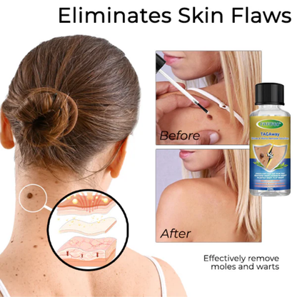 Blendixy™ TAGAway Moles & Warts Removal Solution