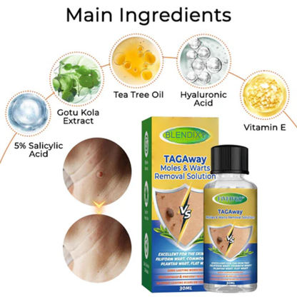Blendixy™ TAGAway Moles & Warts Removal Solution