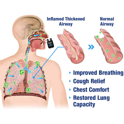 HerbalBreathe Respiratory Cleansing Aerosolizer
