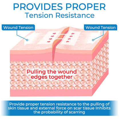 GFOUK™ StitchFree Closure Device